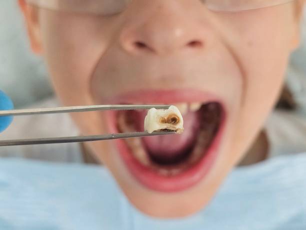 Best Same-Day Emergency Dentist in Bohners Lake, WI
