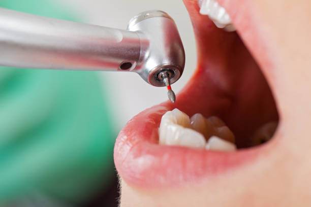 Best Emergency Root Canal Treatment in Bohners Lake, WI